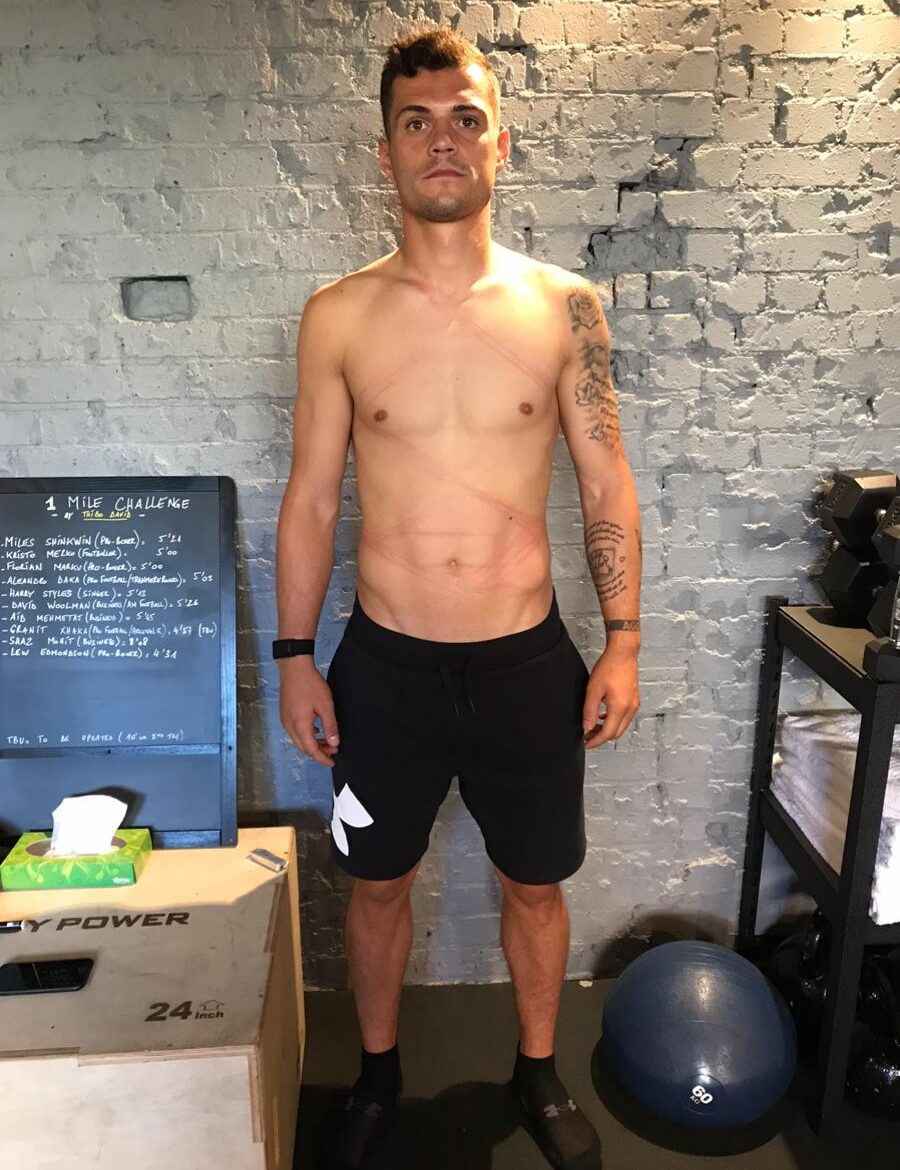 Granit Xhaka